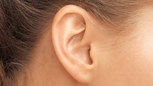 Ear Reshaping (Otoplasty)